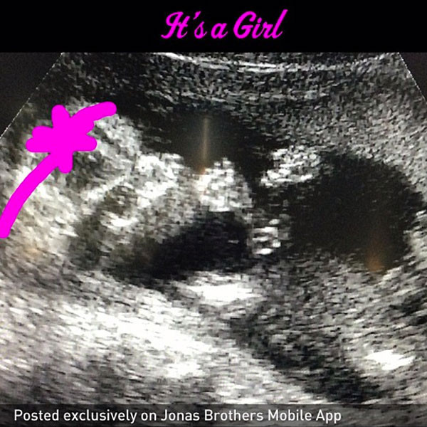 Danielle Jonas, Kevin Jonas, Baby Sonogram Danielle Jonas, Kevin Jonas, Baby Sonogram